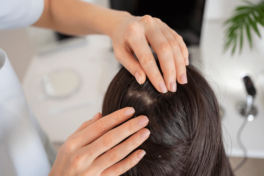 Tình trạng rụng tóc nhiều ở nữ là thiếu chất gì?