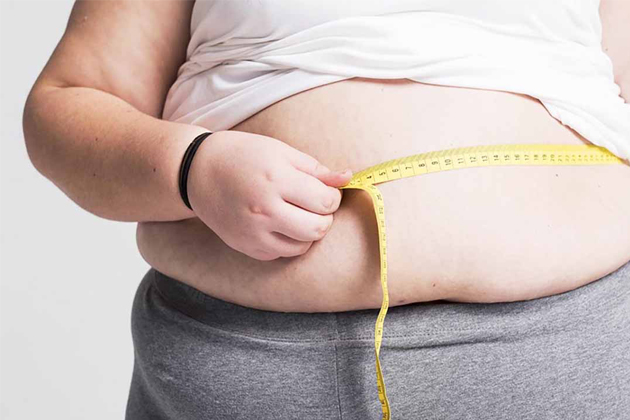 giảm cân béo phì