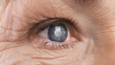 tăng huyết áp gây biến chứng ở mắt