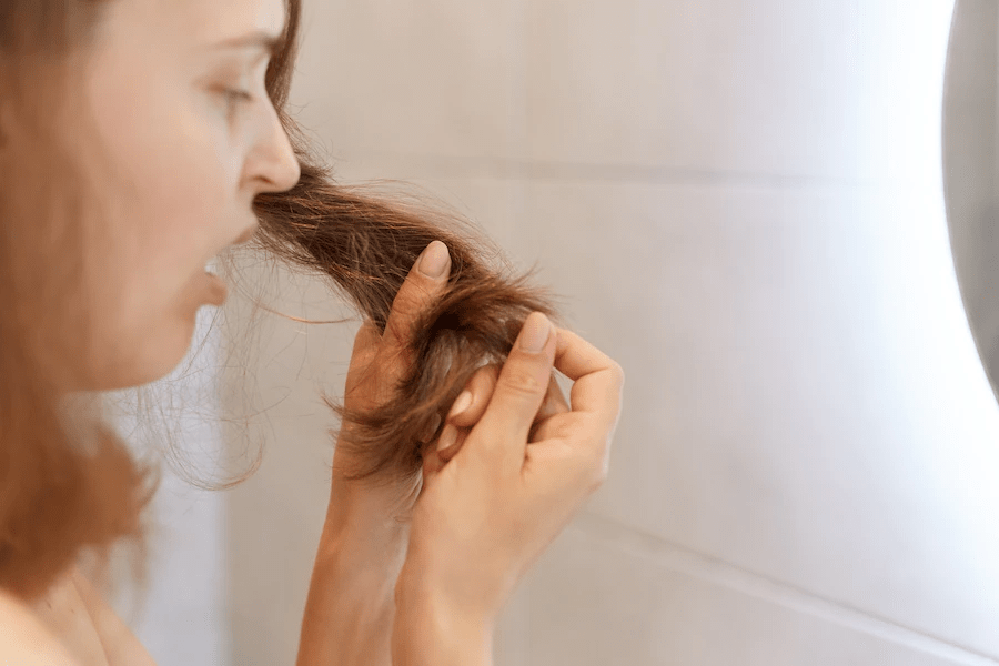 Rụng tóc nhiều ở nữ