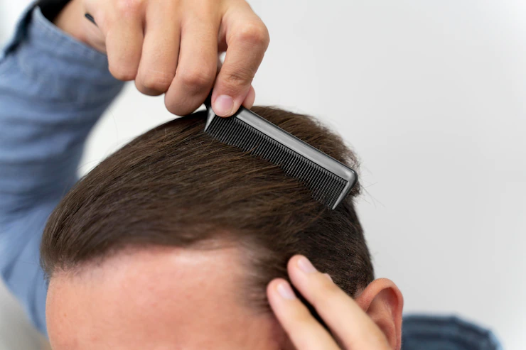 Cách khắc phục rụng tóc ở nam giới